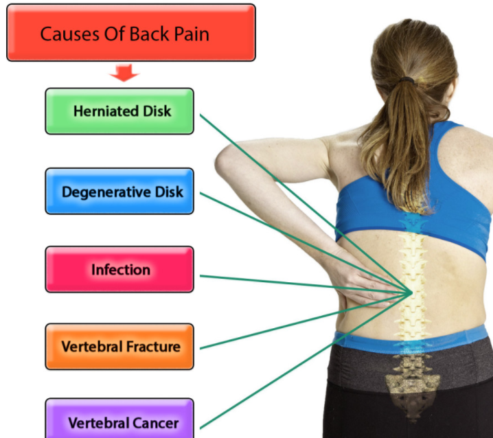 Causes of Back Pain: What Causes Back Pain?