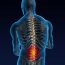 Back Pain Symptoms