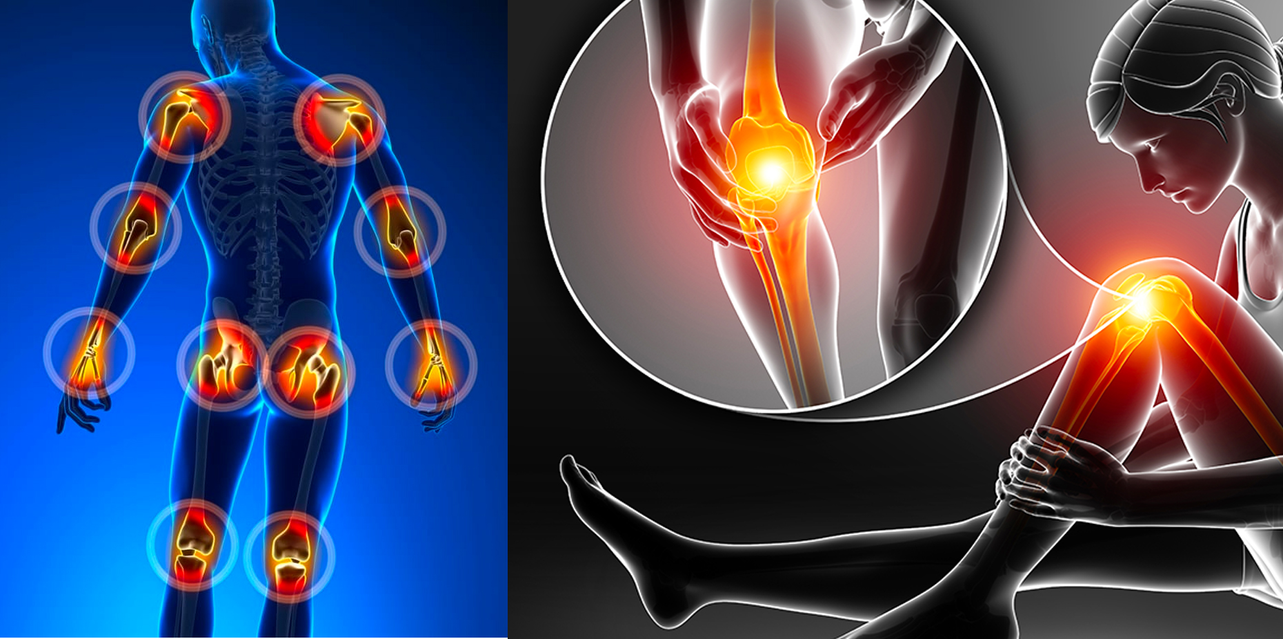 Arthritis: Types, Causes, Symptoms, Treatment, and More