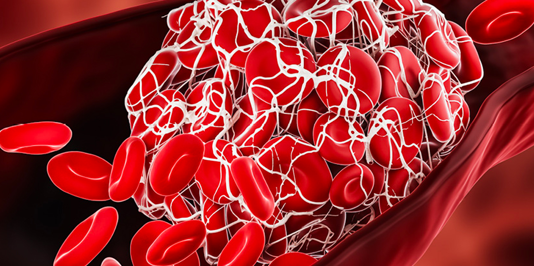 Blood Clots: Types, Causes, Symptoms, Treatment, and more