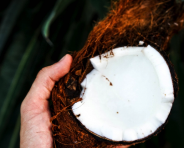 Coconut Oil for Sunburn