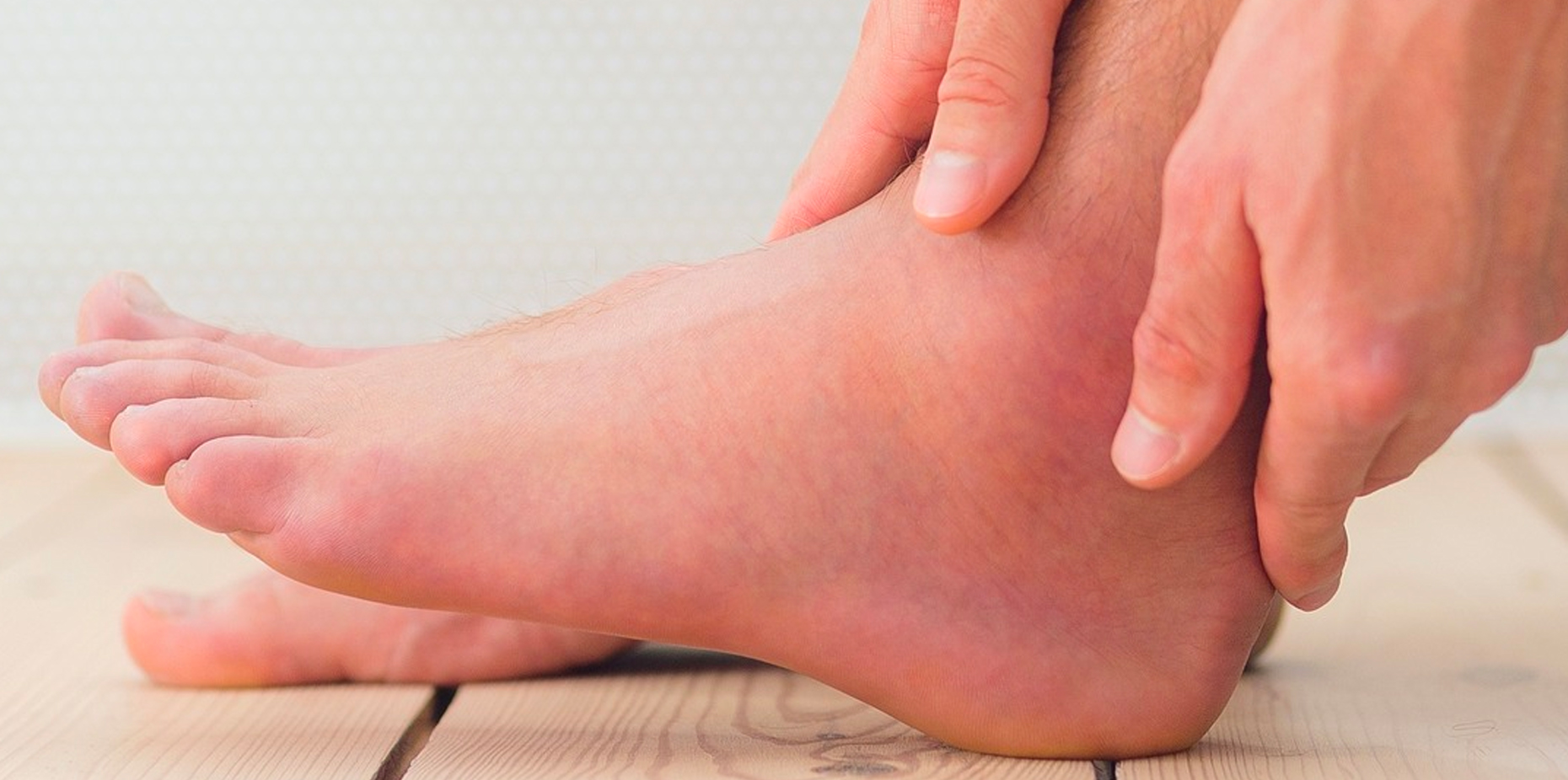 Gout: Symptoms, Causes, Treatments and More