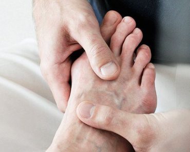 How to Lower Uric Acid?