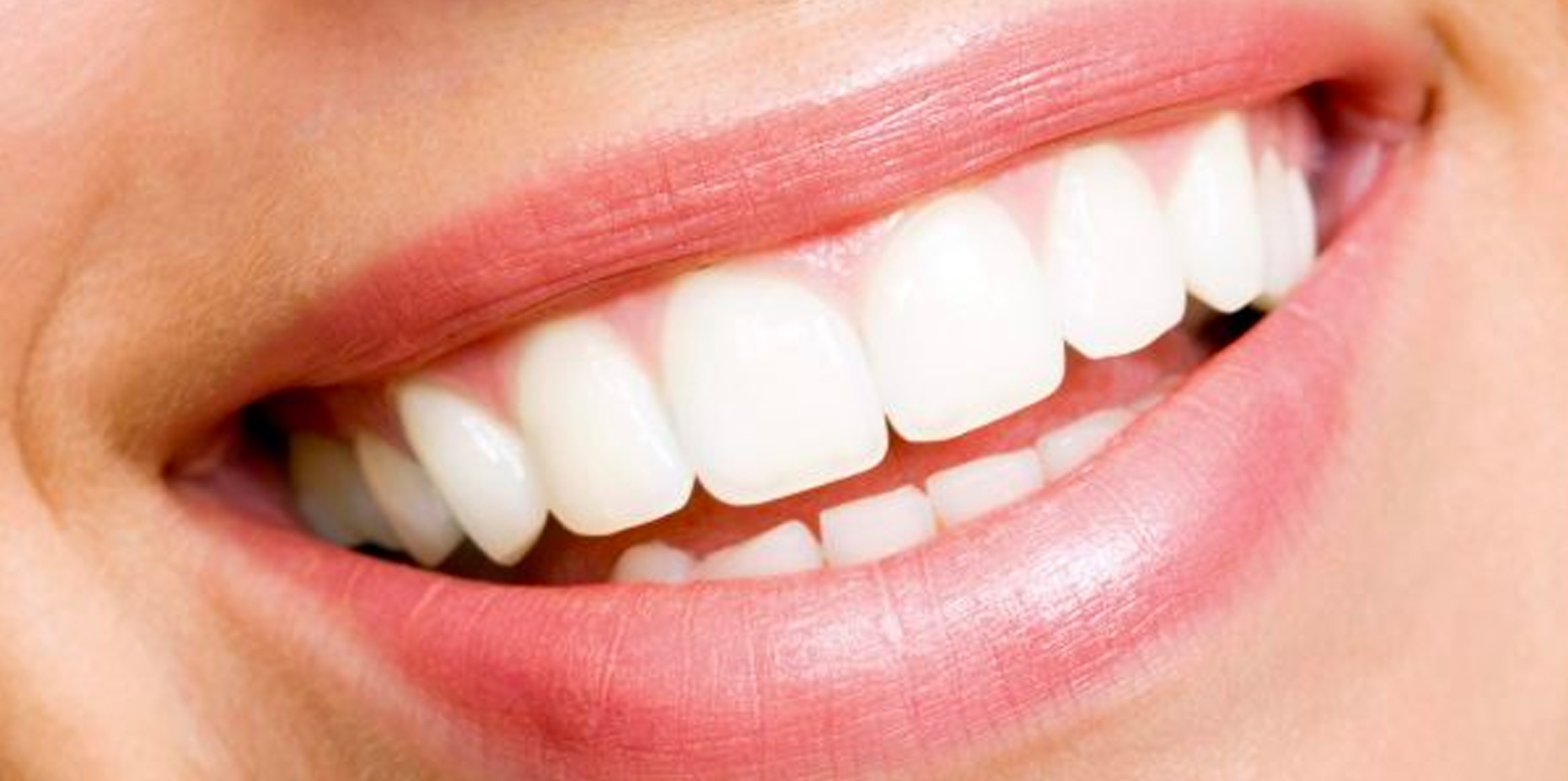 How to Whiten Teeth at Home – 11 Natural Ways