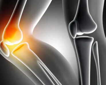 Osteopenia