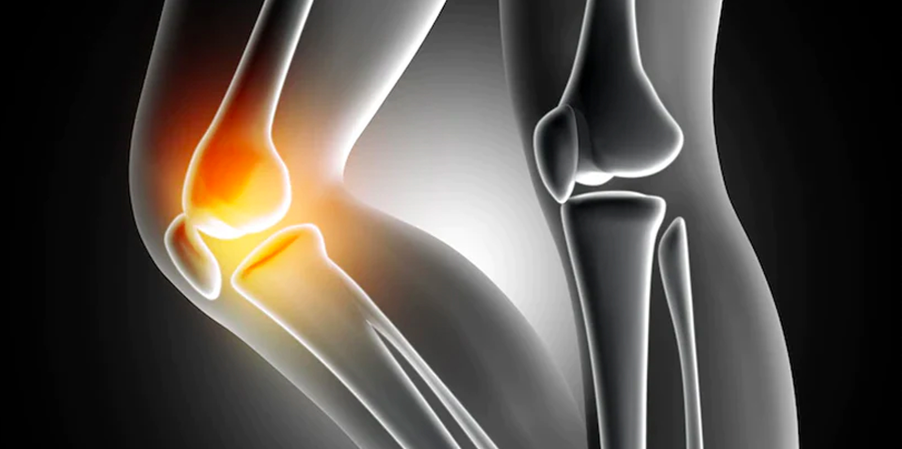 Osteopenia: Causes, Diagnosis, Treatments, and More