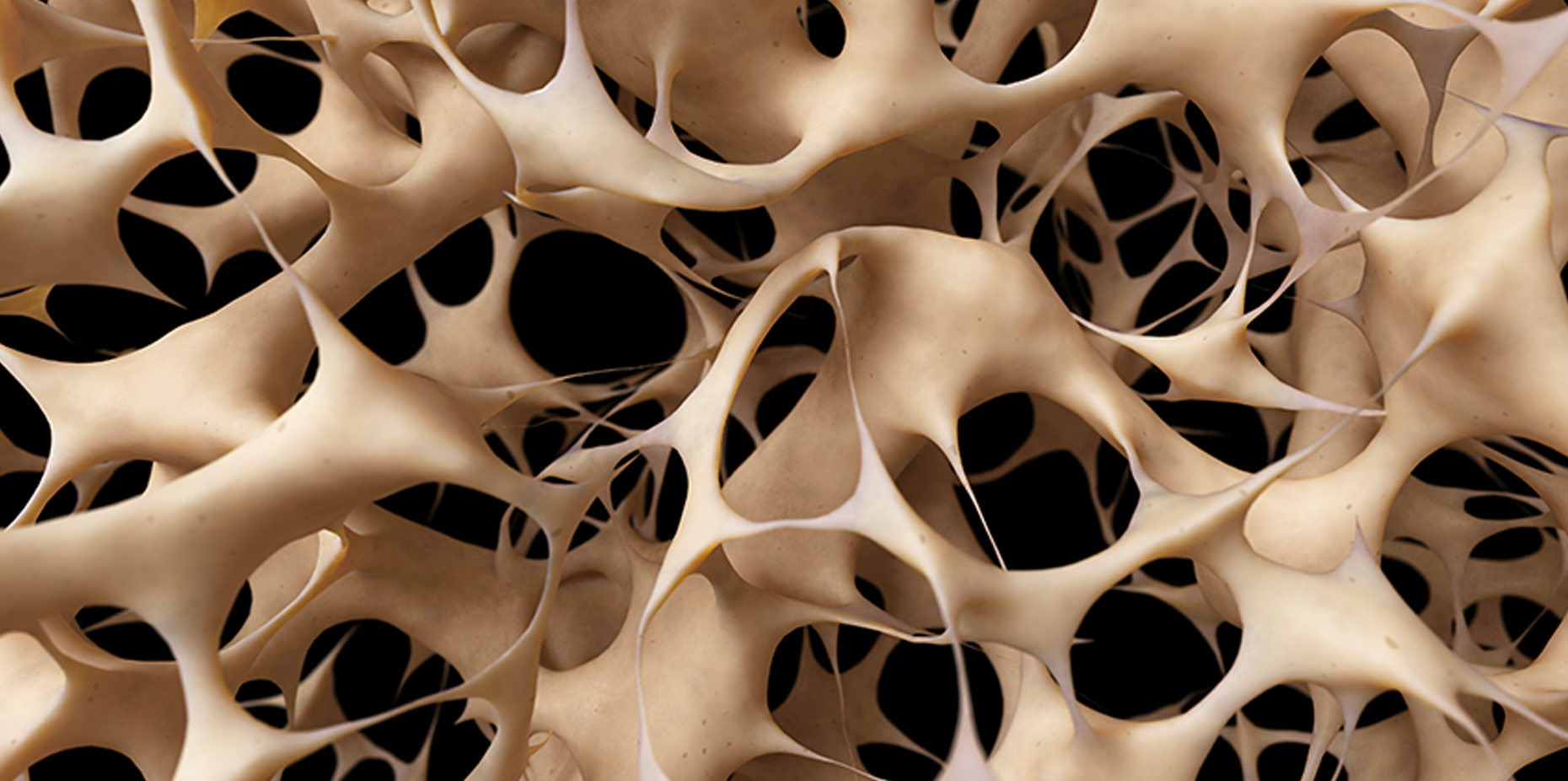Osteoporosis: Symptoms, Causes, Treatments, and More