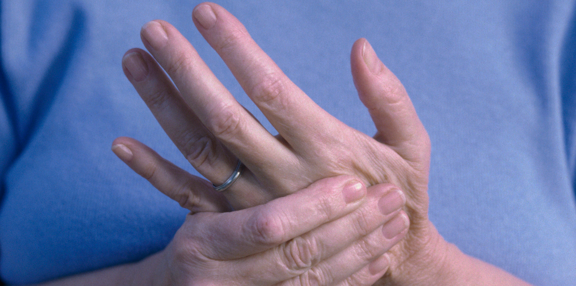 Psoriatic Arthritis: Symptoms, Causes, Treatments, and More