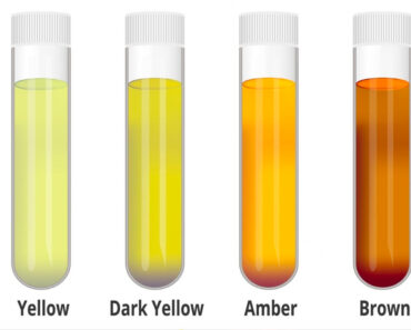 Urine Color Chart