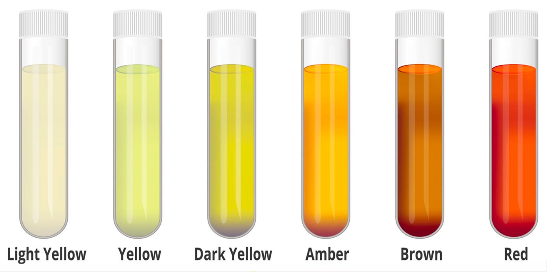Urine Color Chart: Urine Color & Your Health
