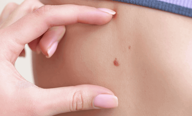 14 Early Signs & Symptoms of Cancer in Women