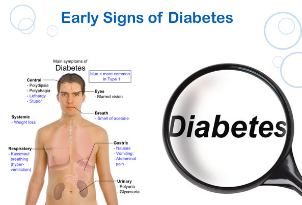 Signs and Symptoms of Type 2 Diabetes