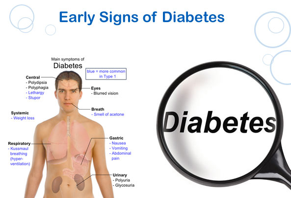 type 2 diabetes symptoms