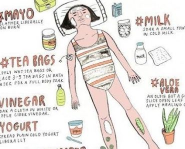 Sunburn Home Remedies