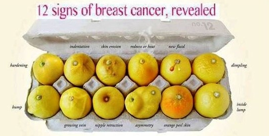 Breast Cancer Symptoms Signs And Symptoms Of Breast -4185