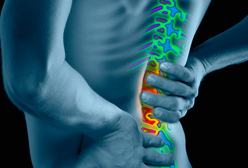 What is Back Pain?