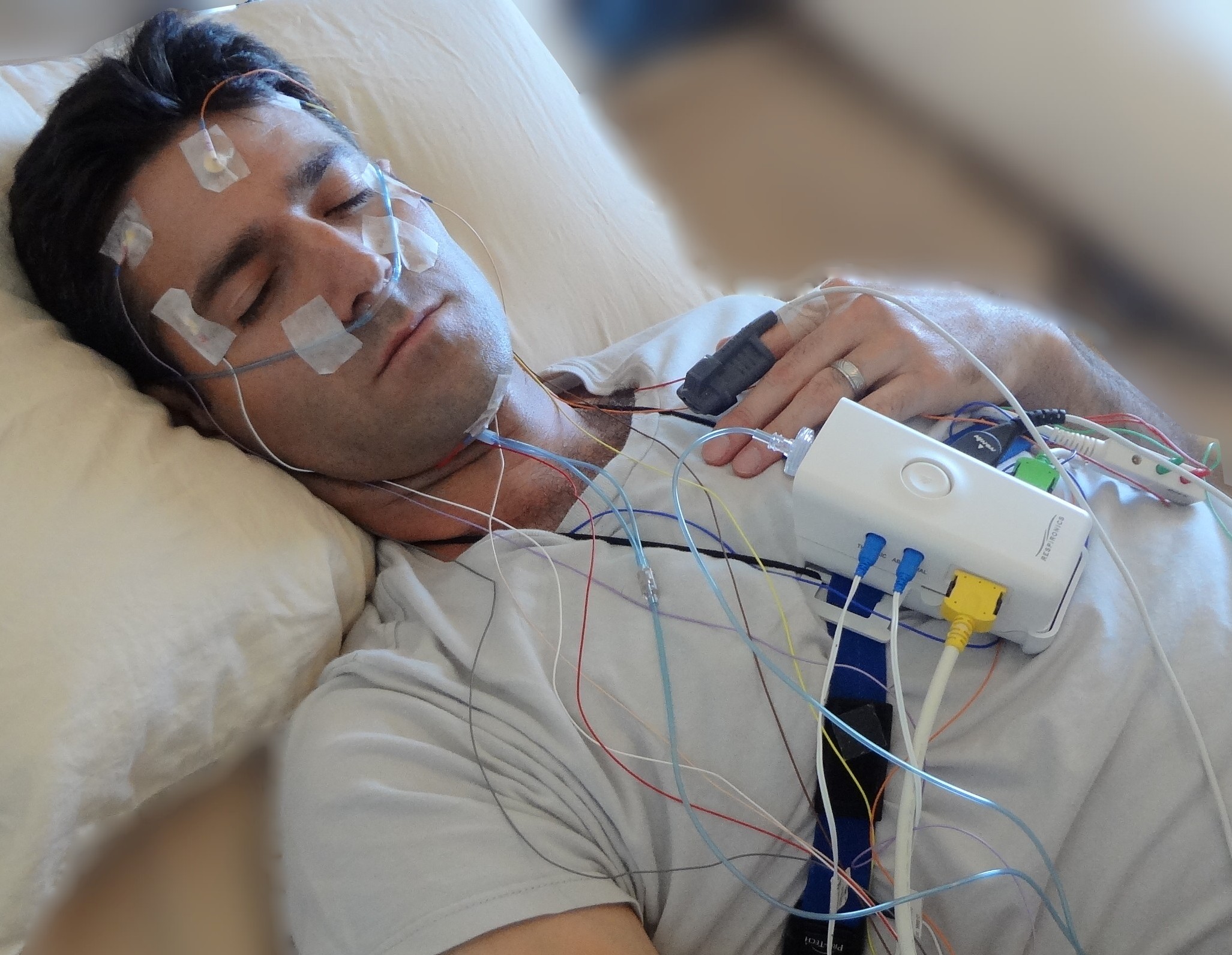 Sleep Apnea Definition In Chinese