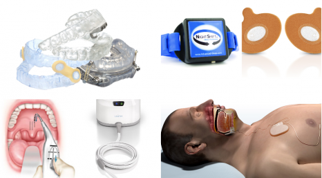 Sleep Apnea Treatment