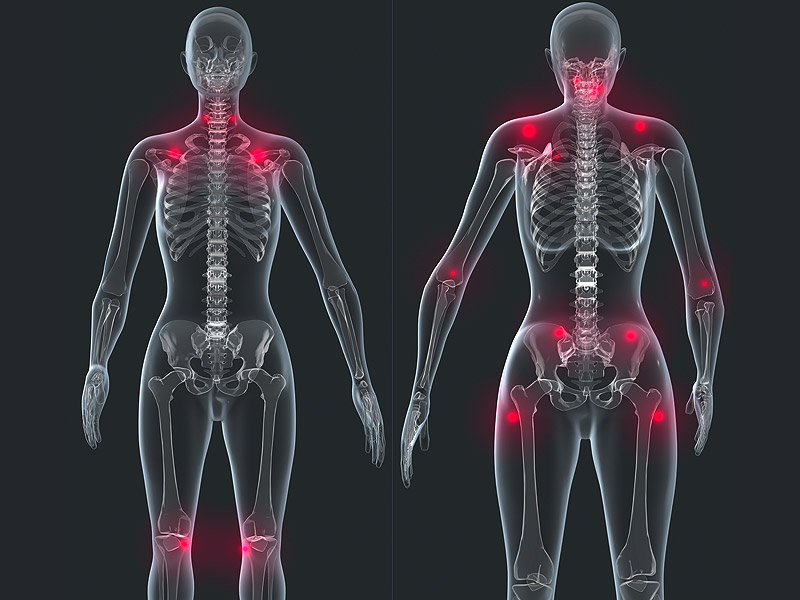 Fibromyalgia Center